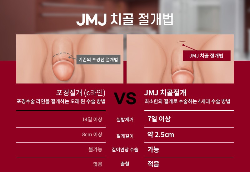 닥터조물주 꽈추형이 직접 집도하는 Jmj5 복합수술 : 네이버 블로그